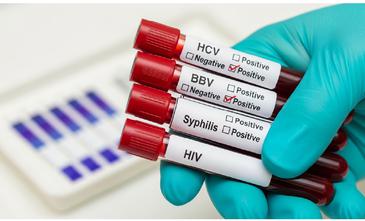 Curso de infecciones de transmisión sexual